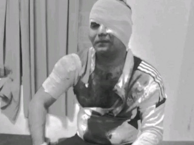 जेन जी आन्दोलनसँग संलग्न भएको आरोपमा एकजनामाथि खुकुरी प्रहार